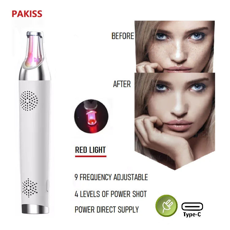 Portable Rechargeable Tattoo Removal Device Mole Removal 9 Modes Bule Light or Red Light Picosecond Mini Laser Pen