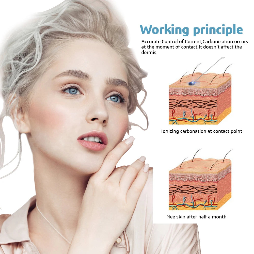 Plasma Pen Eyelid Lifting Wrinkle Removal Skin Spot Wart Tattoo Mole Remover Home Beauty Tools 2 Level