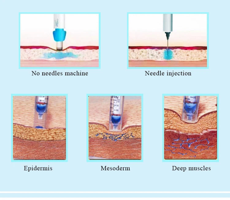 Painless Needle Free Injector Lip Plumper No Needle No Pain for Skin Tightening Face Lift Beauty