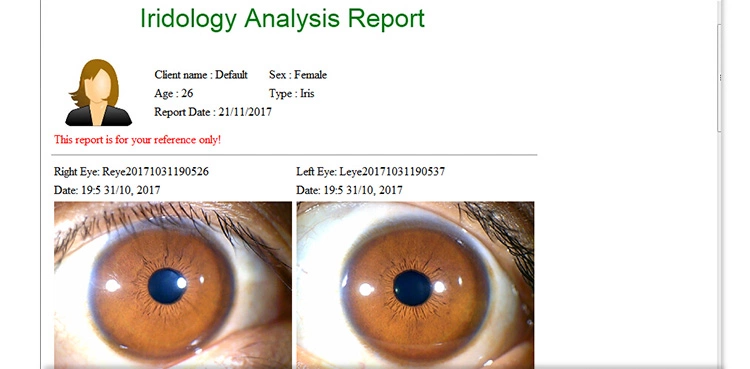 Portable Handheld Iris Scanner 12MP Digital Iriscope Analyzer Iridology Appliance Eye Camera Iris Scanner