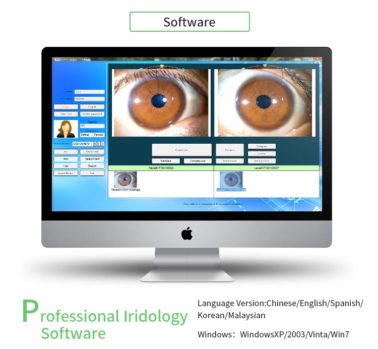 Portable Handheld Iris Scanner 12MP Digital Iriscope Analyzer Iridology Appliance Eye Camera Iris Scanner