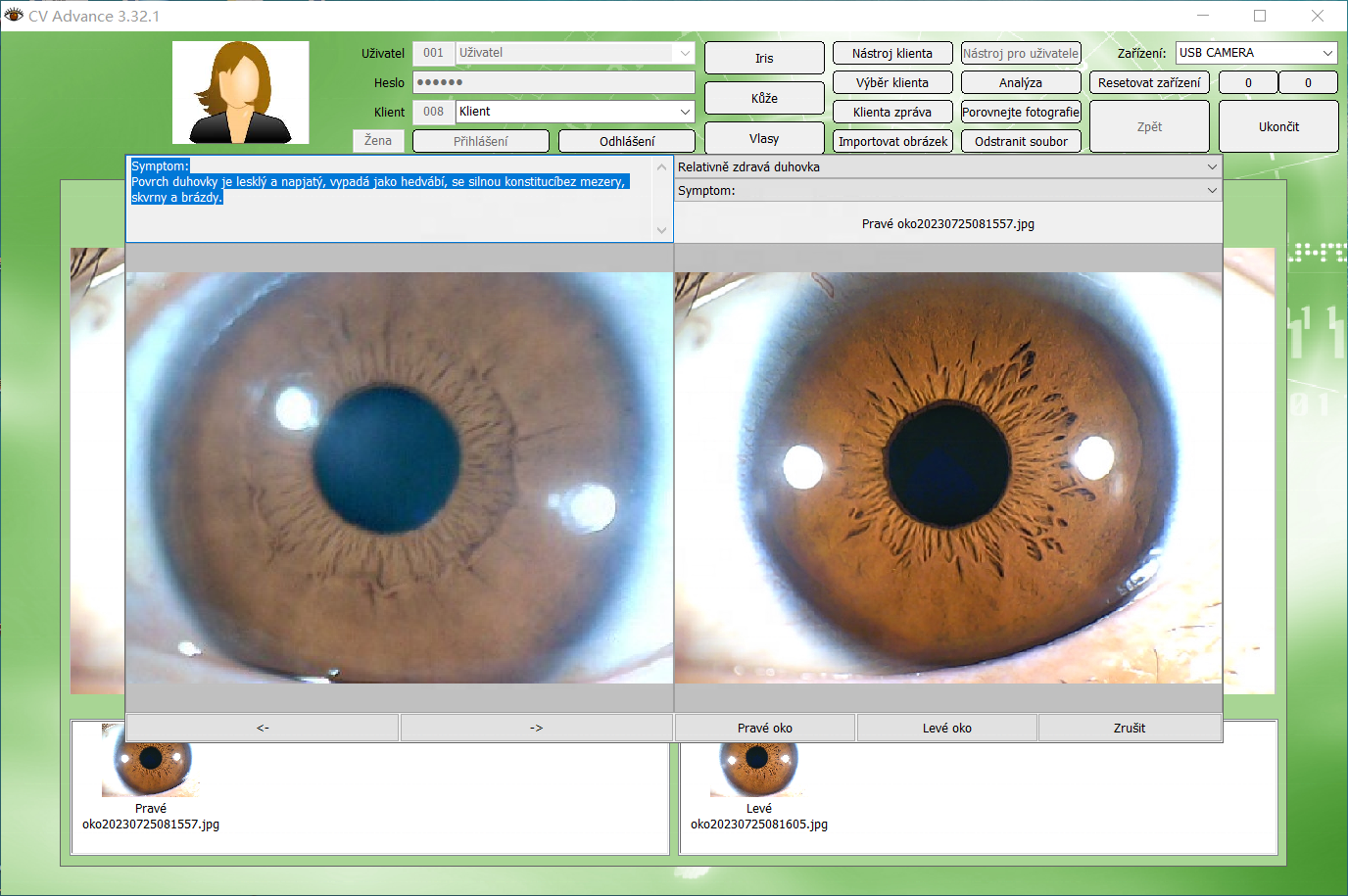 Iridology Camera Chart 5 MP HD 30X Iriscope 9809 Iris CCD Analysis V 3.31 Digital Iriscope Analyzer Iridology Appliance