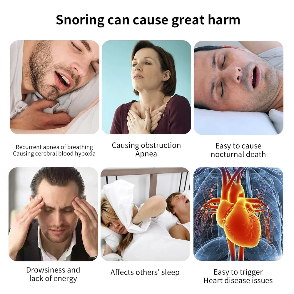 Z3 Pro Snoring Solution, Professional Anti-Snoring Device, 3-Speed Adjustment, Smart Snoring Solution, Breathe Easy, Anti Snore