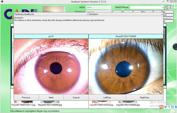 Iridology Camera Chart 5 MP HD 30X Iriscope 9809 Iris CCD Analysis V 3.31 Digital Iriscope Analyzer Iridology Appliance