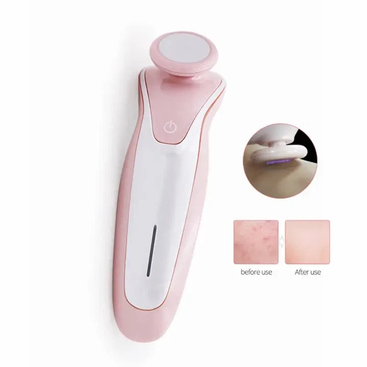 Plasma Facial Beauty Machine Skin Spot Freckle Removal Device Rechargeable Home Anti-Aging Skin Brightening Care Instrument