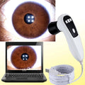 5.0 Mega Pixel High Resolution Iridology Analyzer Machine for Eye Iris Analysis 4 LED/2 LED Lamps Control