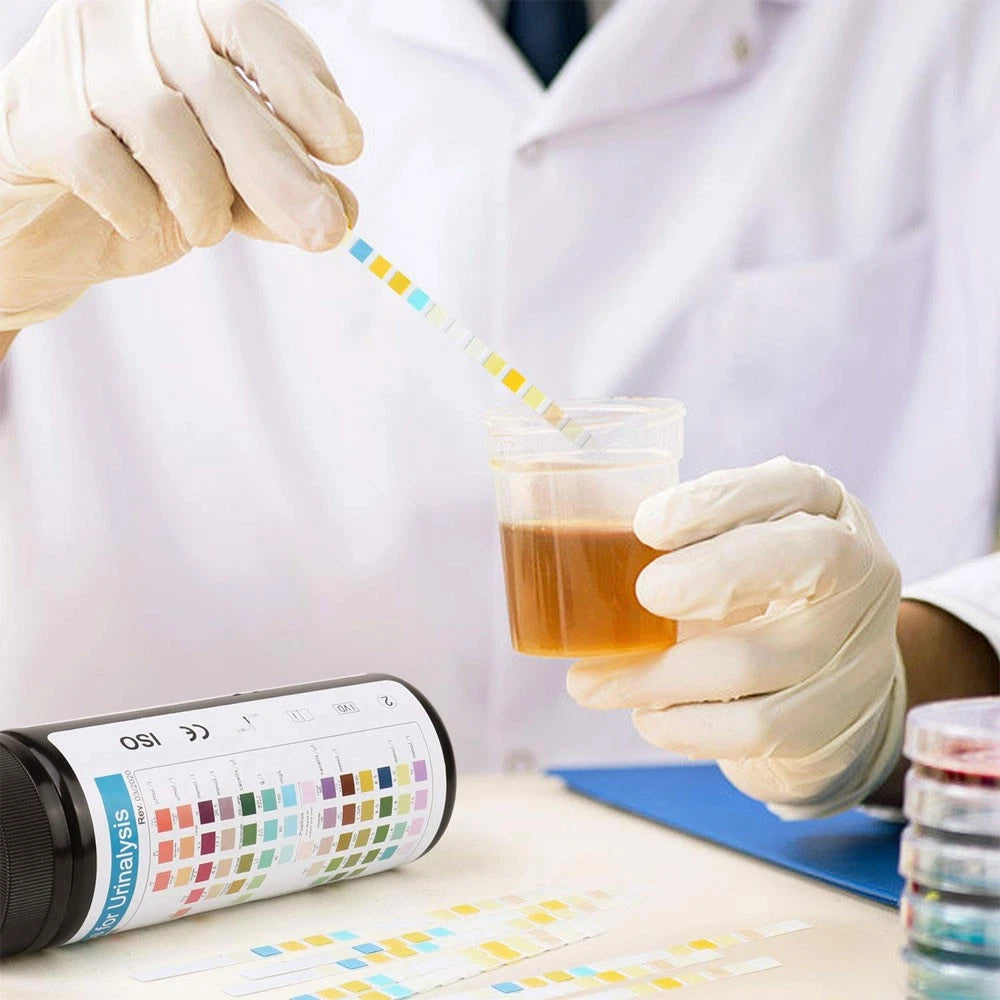 URS-3/9/10/11/12/14 Parameters Urine test Strips test in One Step Urinalysis Strips Reagent
