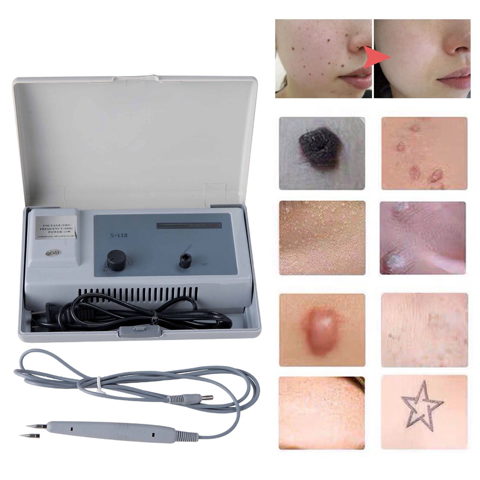 NEW Portable Home Spa 110V Tag Spot Mole Wart Tattoo Removal Treatment Beauty Machine S-113 Model