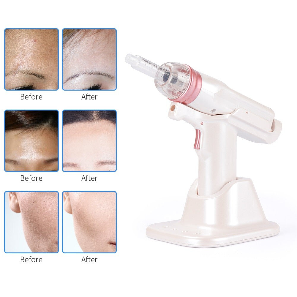 White EZ Non-invasive Hydrating Water Light Meter for Home Use, Portable Water Light Needle, No Leakage Beauty Instrument