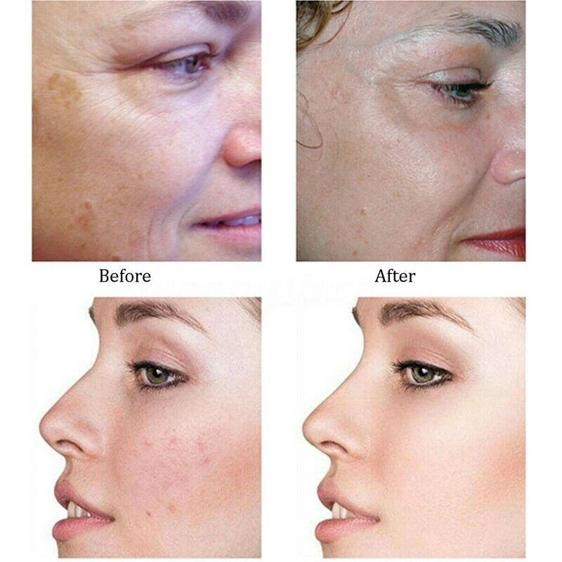Professional Skin Tightening Microcurrent Wrinkle Removal Facial Beauty Enhancement Skin Care Women's Care Machine