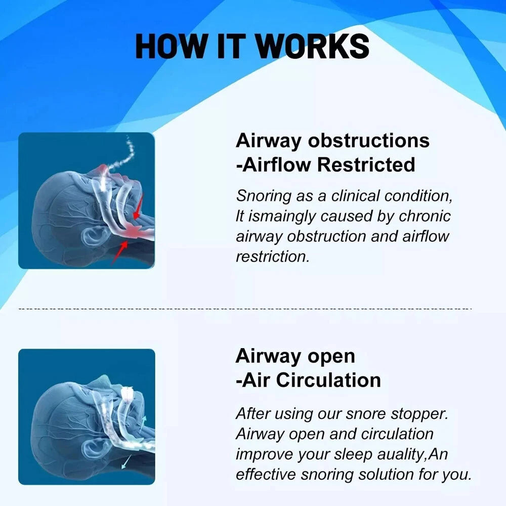 Adjustable Snoring Blocker with Silicone Braces for Men and Women to Prevent Snoring and Snoring