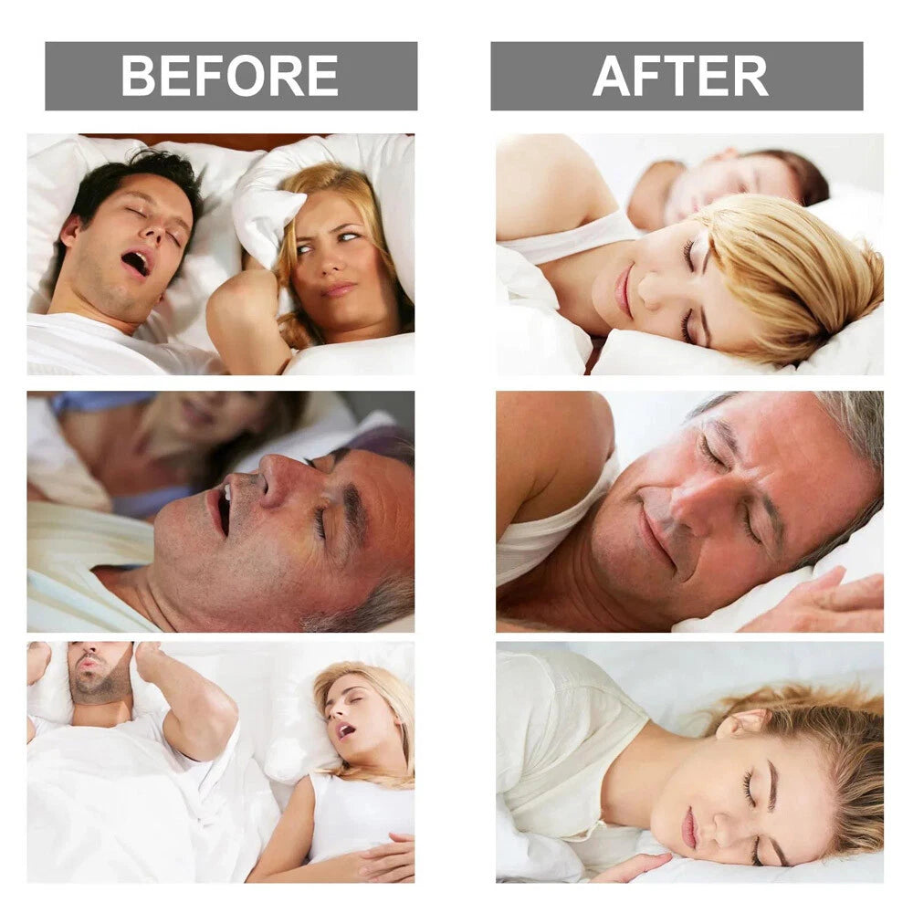 Adjustable Snoring Blocker with Silicone Braces for Men and Women to Prevent Snoring and Snoring