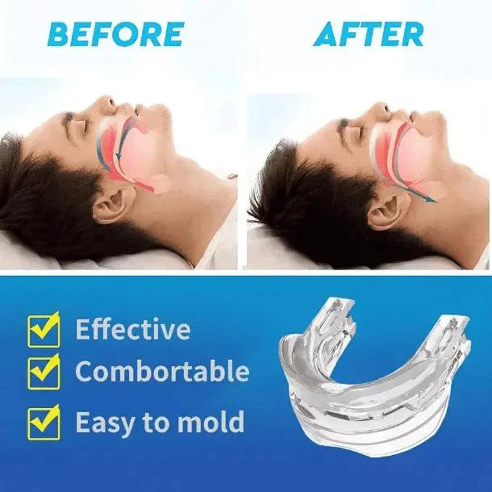 Adjustable Snoring Blocker with Silicone Braces for Men and Women to Prevent Snoring and Snoring