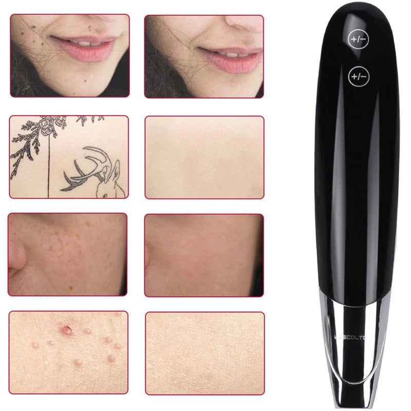 Wireless Picosecond Laser Blue Light Pen For Tattoo Melanin Spot Removal Beauty Machine