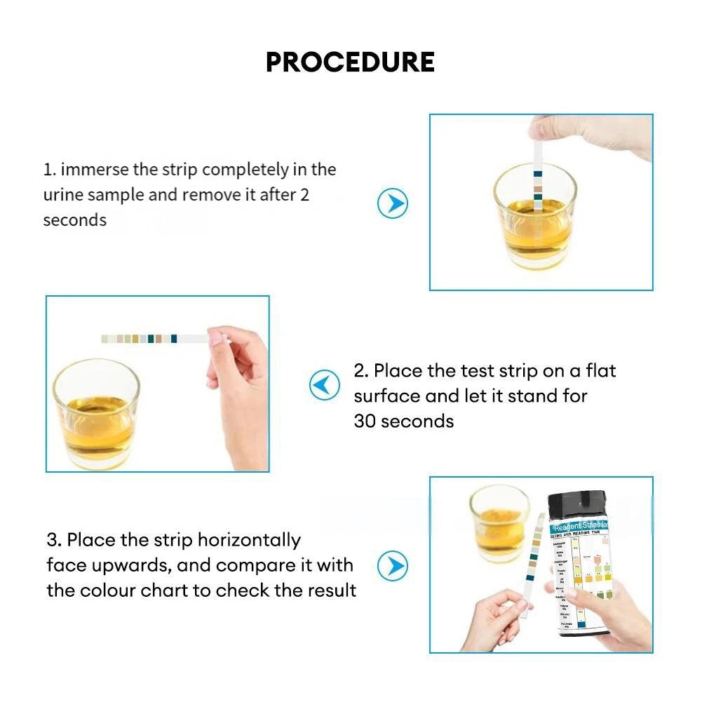 URS-3/9/10/11/12/14 Parameters Urine test Strips test in One Step Urinalysis Strips Reagent