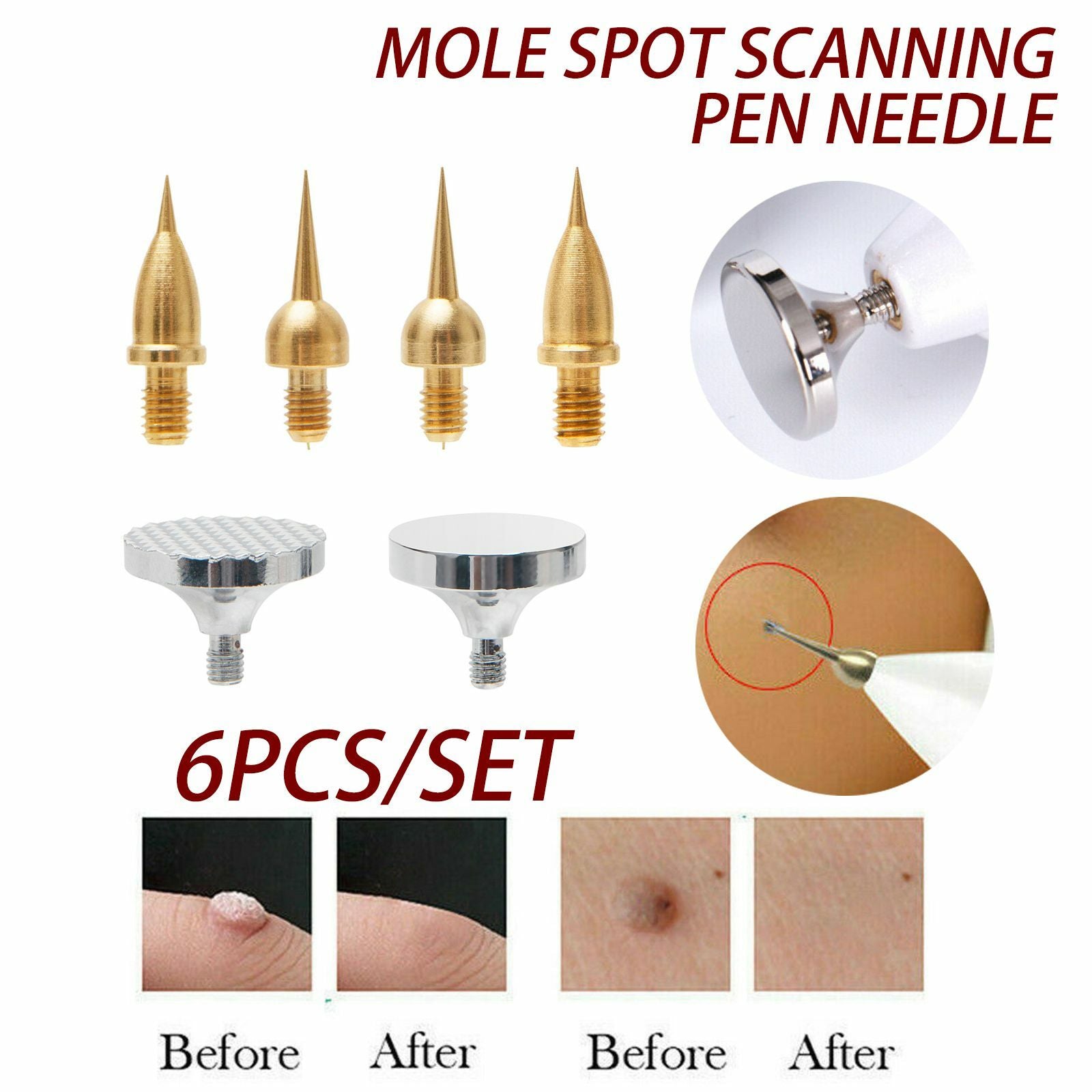 2/6pcs/10 Tips Cartridges Part Accessory Kit for Beauty Monster Plasma Pen Machine Wrinkle Freckle Dark Spots Removal