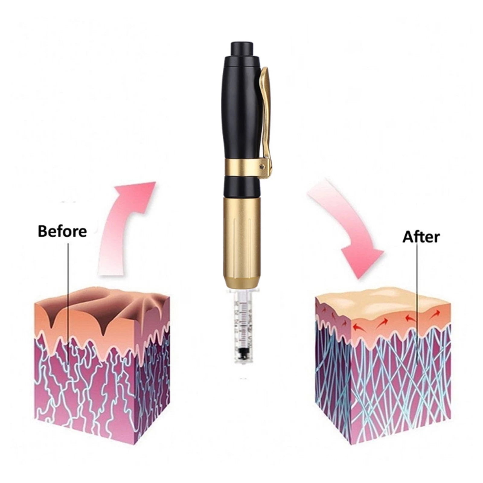 2in1 0.3 & 0.5ml Adjustable Skin Rejuvenation Machine Empty Nozzles Adapter Cap