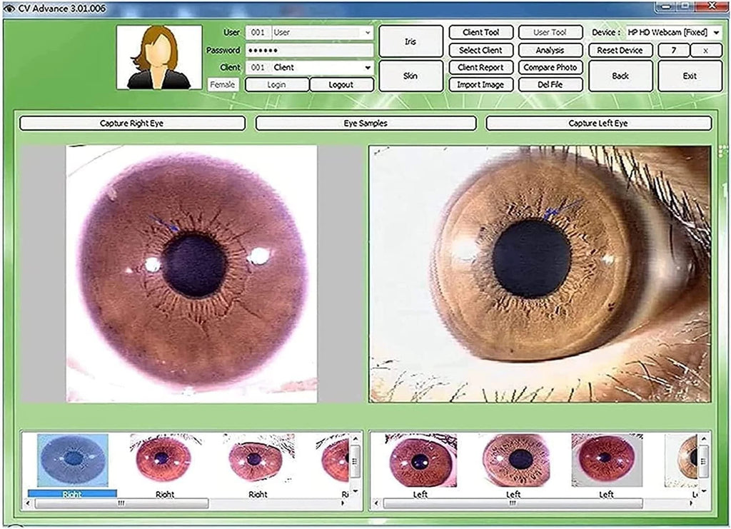 Iridology Camera Chart 5 MP HD 30X Iriscope 9809 Iris CCD Analysis V 3.31 Digital Iriscope Analyzer Iridology Appliance