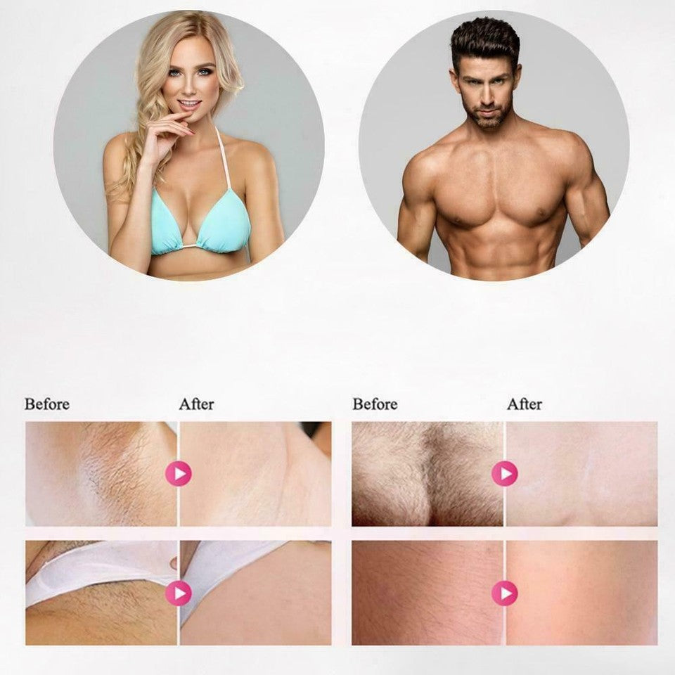 Pink IPL Hair Removal Device 600000 Flashes Permanent Painless Laser Hair Remover Whole Body Home Epilator Machine